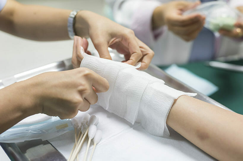 Texas Burn Injury Lawyer