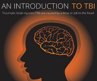 Brain Injury Lawyer Infographic